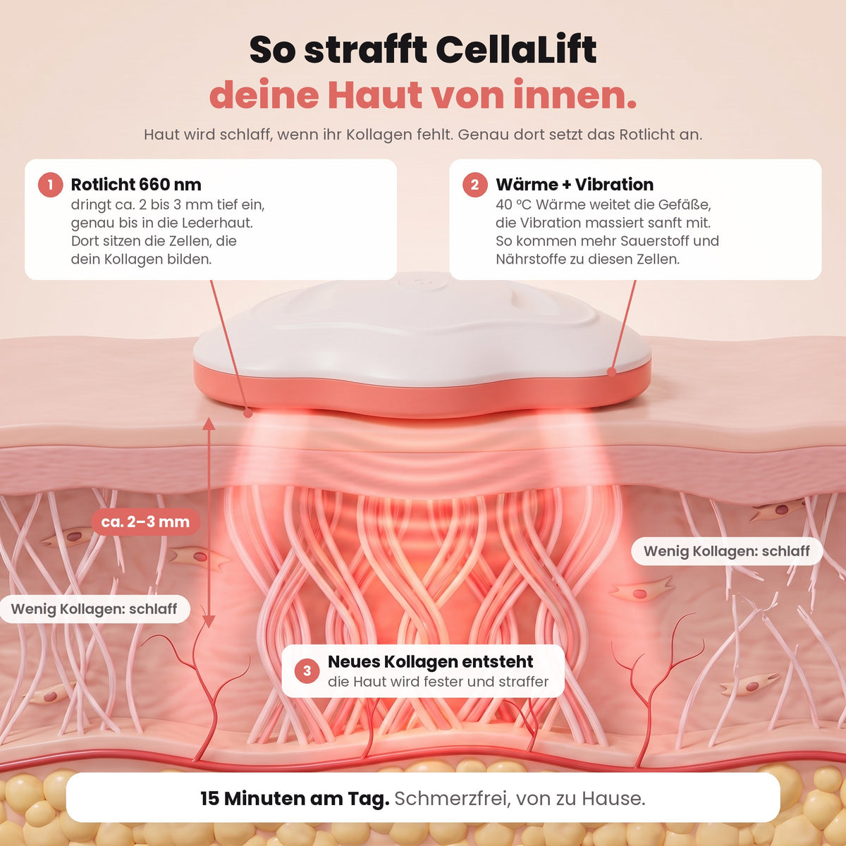 Grafik: So strafft CellaLift die Haut von innen, Rotlicht 660 nm erreicht die Lederhaut, Wärme und Vibration fördern die Durchblutung