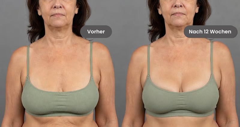 Linda, 49: vorher und nachher