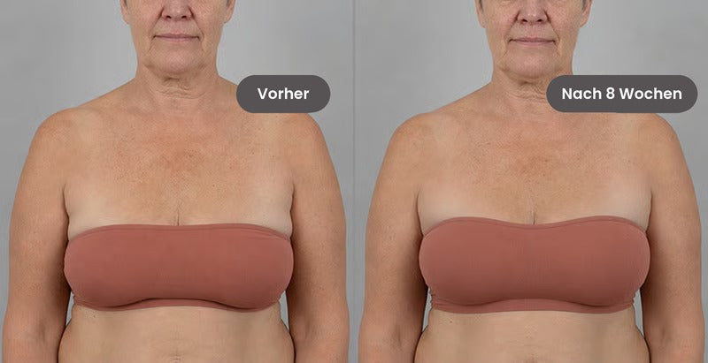 Janette, 57: vorher und nachher